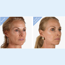Load image into Gallery viewer, Hi-Impact "Illuminating" Serum with Hyaluronic Acid, Vitamin C and EGF's