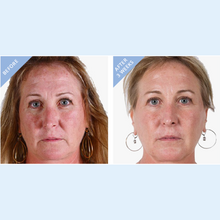 Load image into Gallery viewer, Boost Night Creme